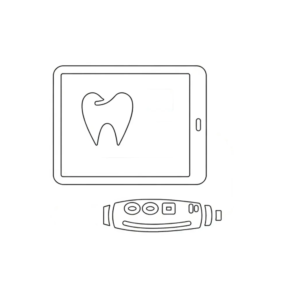 Intra Oral Scan Dark