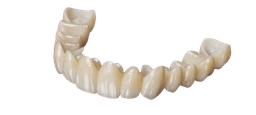 Zirconia Restorations